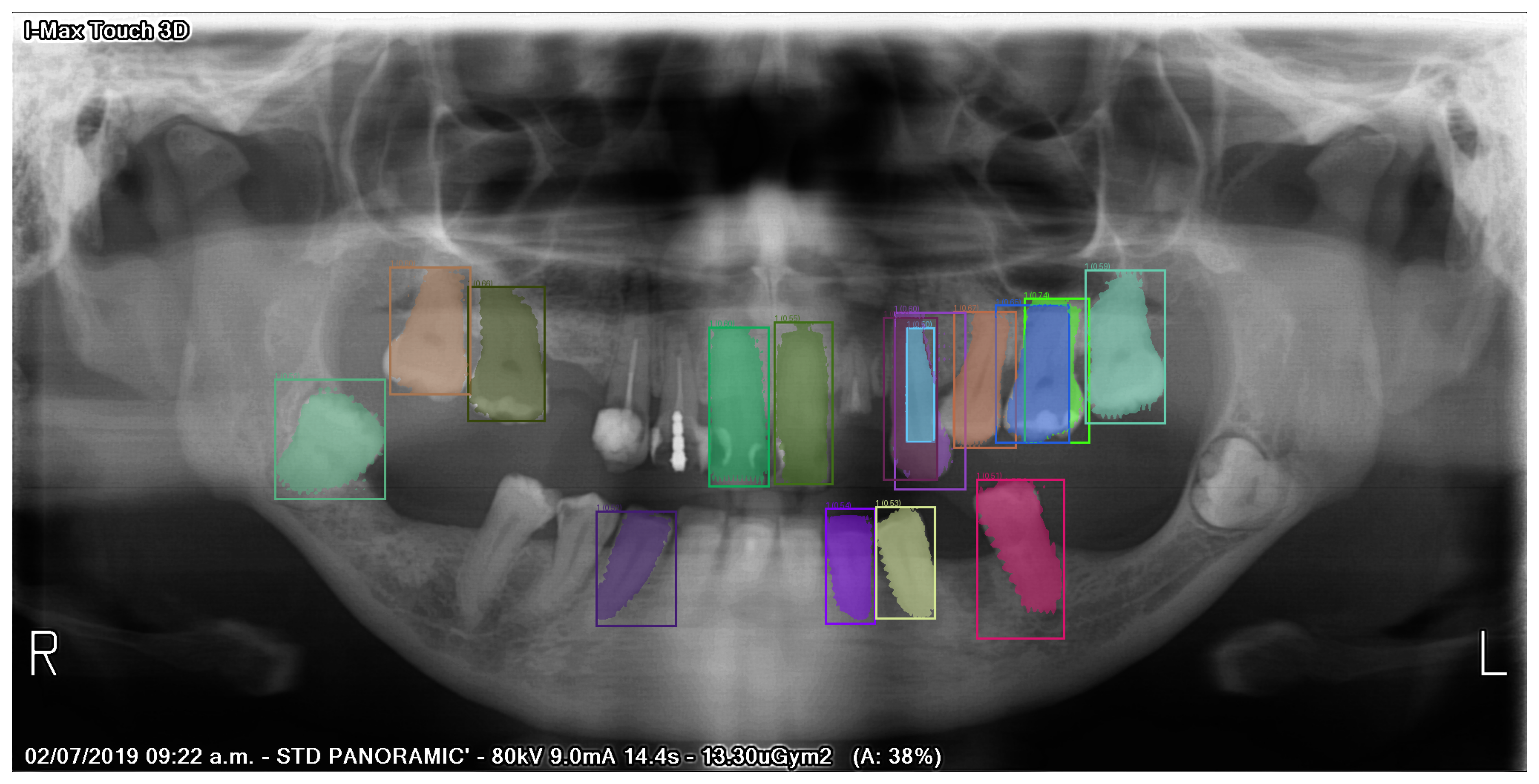 ../_images/4b42e3e9170a23151f6bac97c8f55946c2fb17fb7cba08c4eec6416a053cc118.png