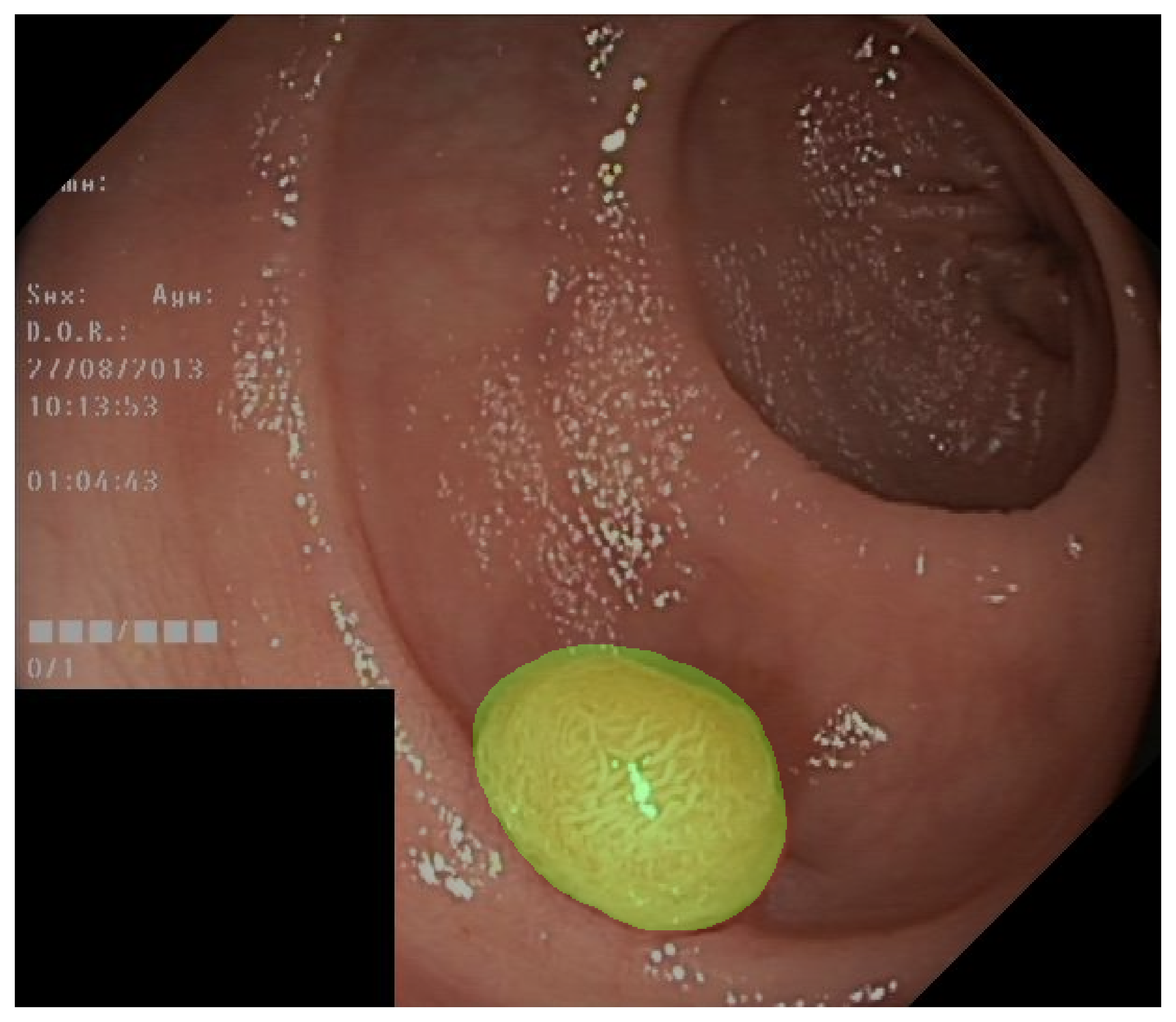 ../_images/959ccca0f0a511f91889d429f65ead717093d6539c4c0a150449104e2cf95c1e.png