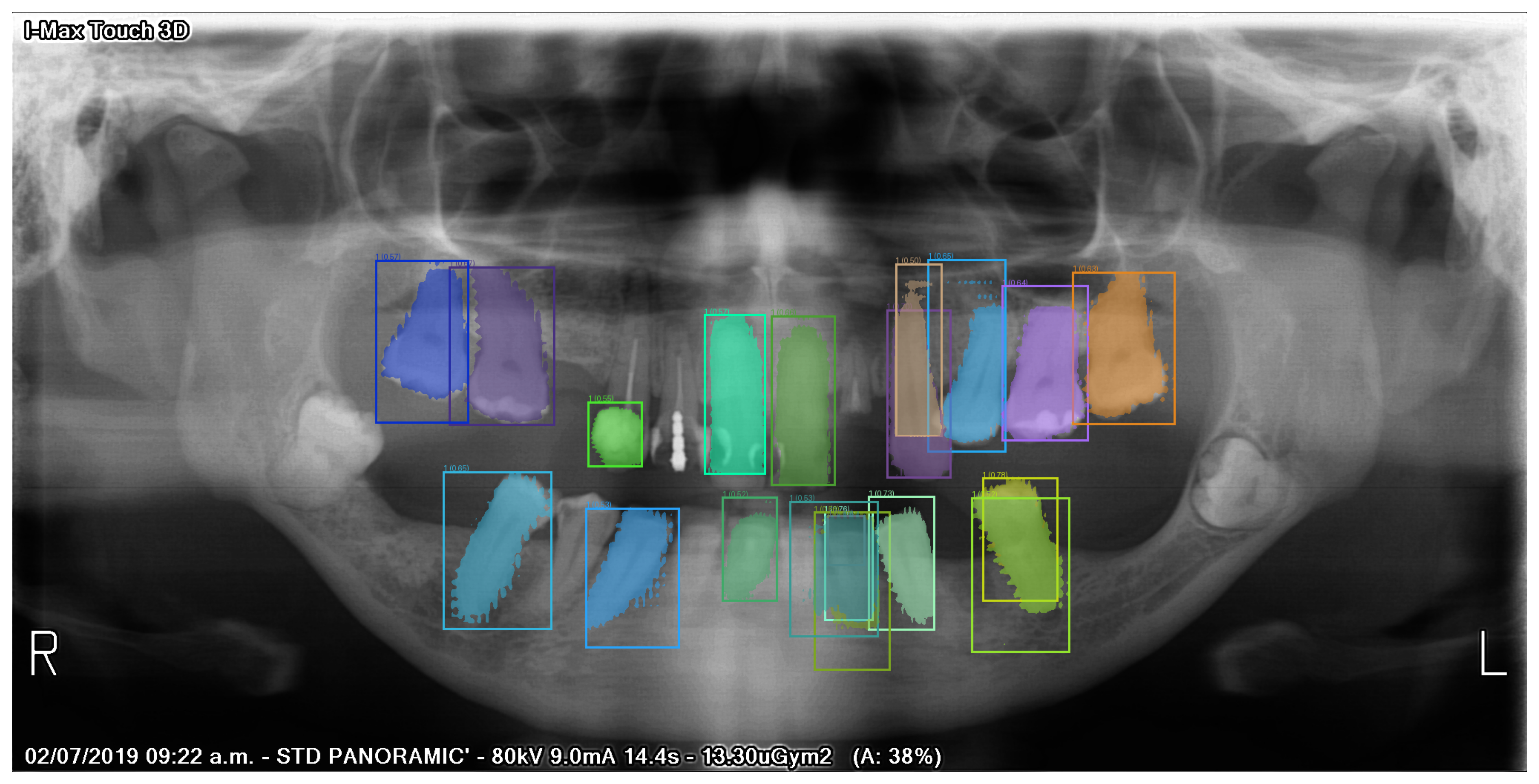 ../_images/99202b5075ec48b208c2d0aa94fefdb30161bd6ae34ef38a35906dbd98d167a5.png