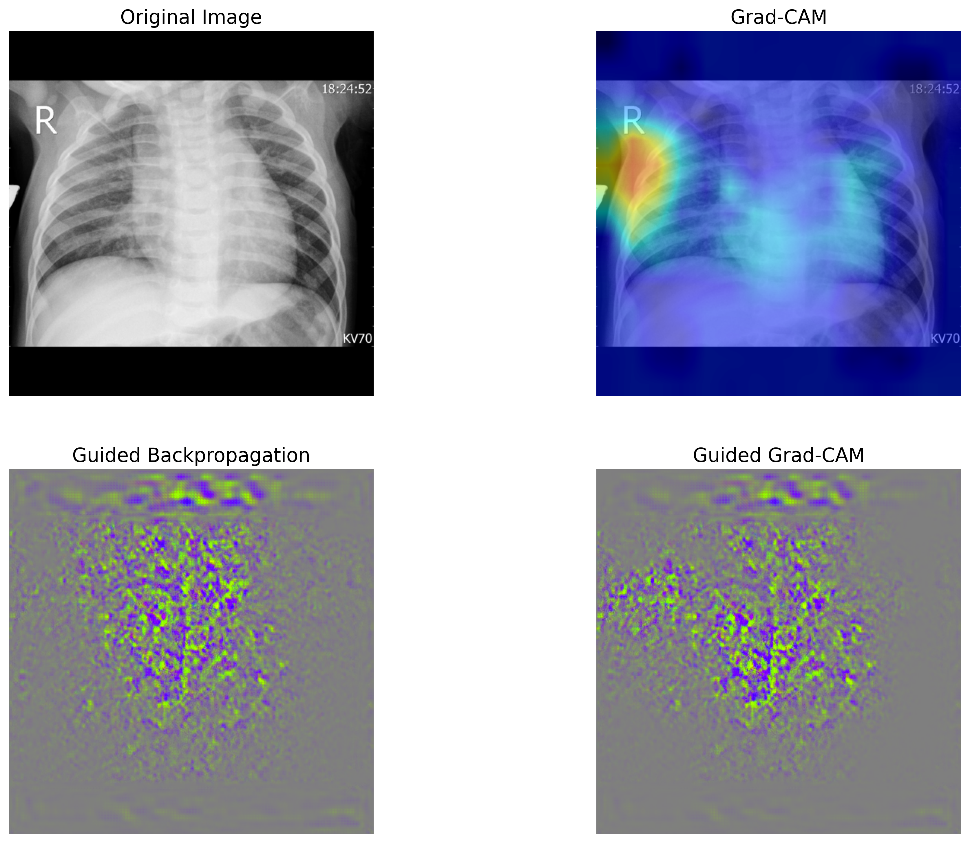 ../_images/a2446d48c568d03381407c0e8527298a43b5b439dd748fda7512dfd756aad8ce.png