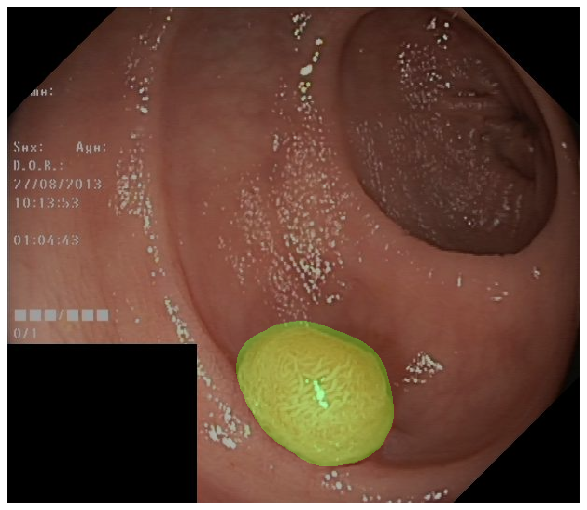 ../_images/fc7cd082c7a5a63ab6523df0c132f69d23fdcffe37e0de833ebea6d0d1ec457b.png