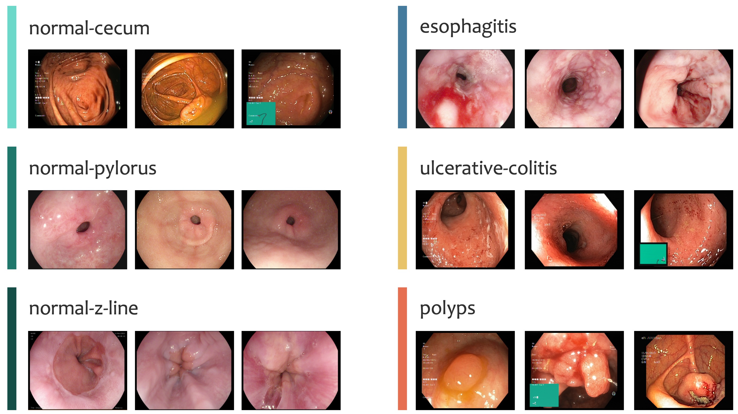 ../_images/kvasir_classification_dataset.jpg